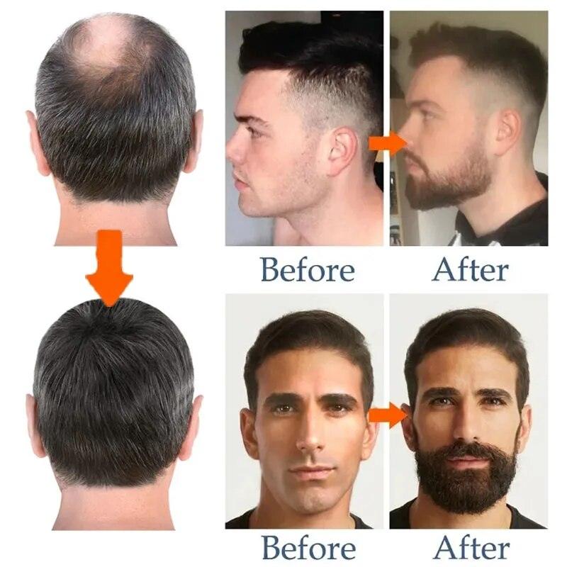 Fast Acting Beard Growth Serum